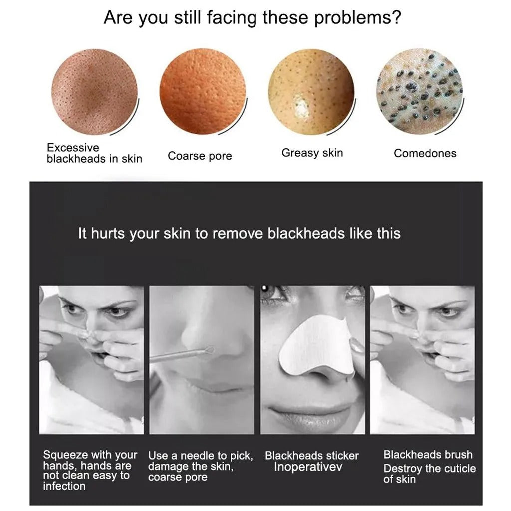 5 In 1 Electric Blackhead Acne Oil Remover