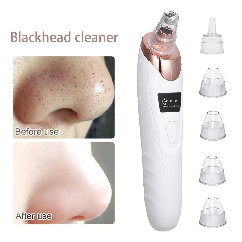 5 In 1 Electric Blackhead Acne Oil Remover